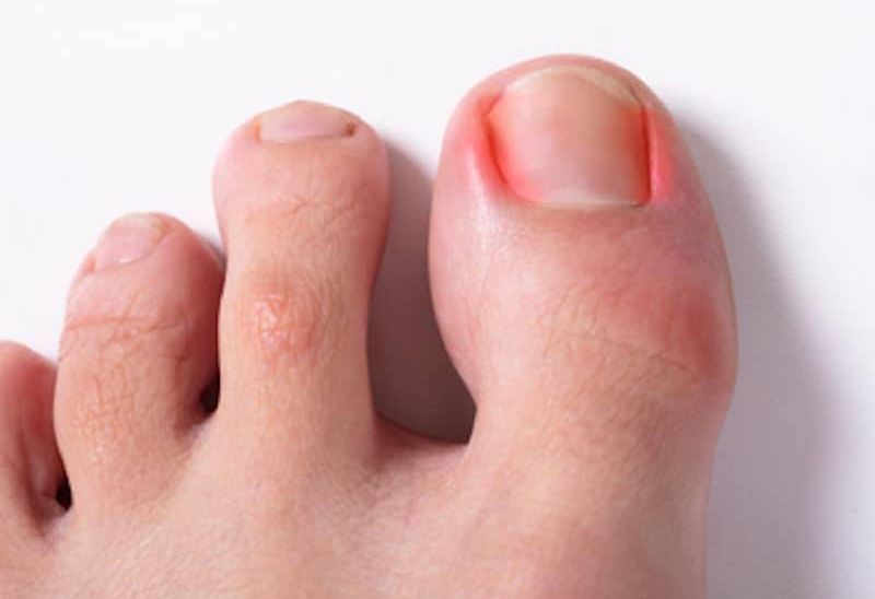 62f3c87a33f545f8393a0af8_lani-city-med_procedures-4-p-800