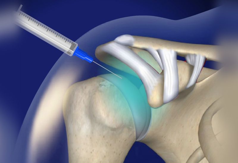 62f3c87b5606d838f8b417b2_lani-city-med_procedures-7-p-800