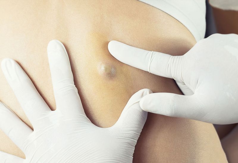 62f3c87c33f545ea3b3a0b00_lani-city-med_procedures-5-p-800