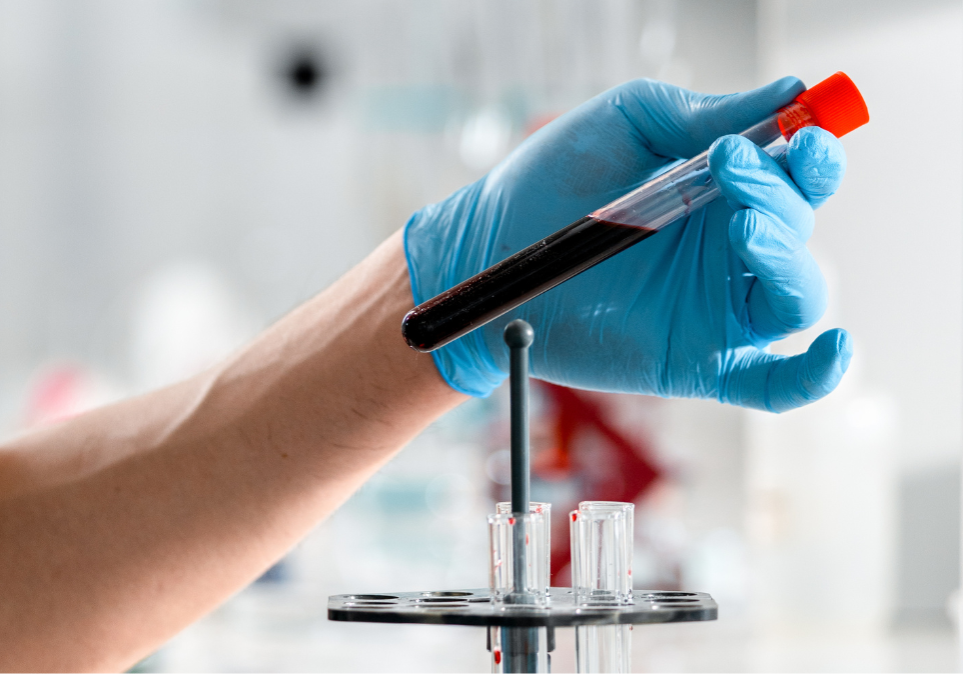 STD Testing