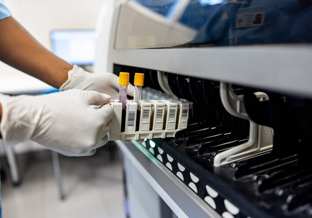Close-up on a technician analyzing blood samples at the lab and holding a test tube - healthcare and medicine