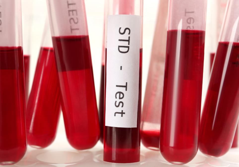 STD Testing